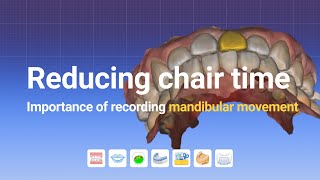 Reducing chair time  Importance of recording mandibular movement [upl. by Berger]