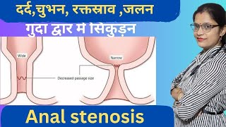 anal stenosis causes symptoms and homeopathic medicineगुदा द्वार में सिकुड़न कारण लक्षण और उपाय [upl. by Eerahc756]