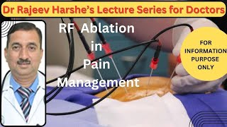 RF Ablation in Pain management [upl. by Micheal]