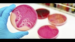 Morphology of Mycobacterium Avium Infectious Complex [upl. by Eillam469]