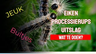 Eiken processierups uitslag  Wat te doen tegen jeuk en bultjes [upl. by Airotna]