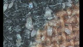 house dust mites [upl. by Devona]