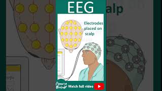 EEG  Electroencephalogram  How EEG works  1 minute pathology [upl. by Skipp]