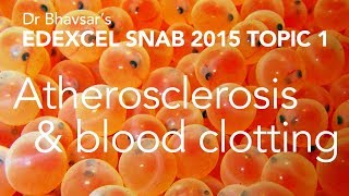 Edexcel SNAB A level biology atherosclerosis and blood clotting topic 1 [upl. by Anelah]