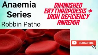 Anaemia by Diminished Erythropoiesis amp Iron Deficiency Anaemia [upl. by Rramaj]