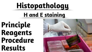 Histopathology H and E staining Principle reagents Procedure Results Tissue staining [upl. by Barina]