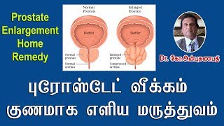 புரோஸ்டேட் வீக்கம் குணமாக எளிய மருத்துவம்  Prostate Enlargement Home Remedy [upl. by Halueb924]