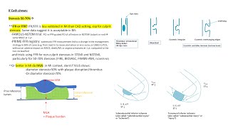 NSTEMI angiographic and PCI tips [upl. by Assinna]