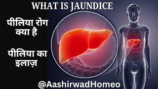 Jaundice  Hemolytic jaundice  Piliya ke lakshan  Why jaundice occurs  Aashirwad Homeo [upl. by Duster]