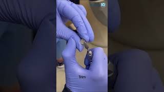 Temporary crown tips with Dr Tami shorts [upl. by Nael]