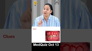 MedQuiz 13 Oct [upl. by Yznel]