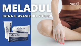 MELADUL Tratamiento para el vitíligo l Frena la expansión de las manchas blancas [upl. by Ranite]