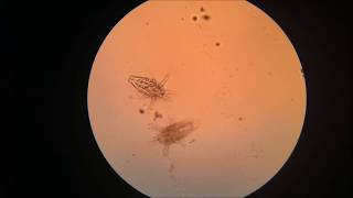 Zooplankton in the Microscope [upl. by Imena360]