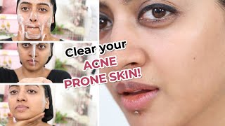 Salicylic Acid Acne Prone Skin Care Routine [upl. by Demmer517]