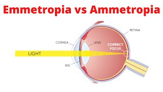 Emmetropia vs Ammetropia [upl. by Sheryl]