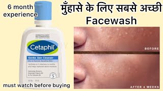 Full Review in Hindi Cetaphil Face Cleanser cetaphilcleanser cetaphilgentleskincleanser cetaphil [upl. by Nydnarb]