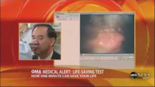 TNE5000 Esophagoscope featured on GMA [upl. by Shu520]