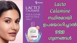 Lacto Calamine Face Lotion  Oil Control Face Cream For Daily Use  Paraben Free Formula [upl. by Lamaj529]