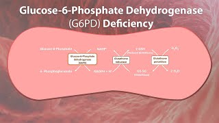 Glucose6Phosphate Dehydrogenase deficiency  G6PD deficiency features Offending amp Safe drugs [upl. by Stanislaus109]