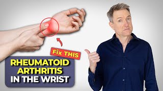 Rheumatoid Arthritis In The Wrist  How To Fix It [upl. by Sikleb]