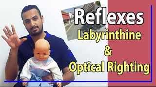 13 Difference between Labyrinthine amp Optical Righting [upl. by Alaet]