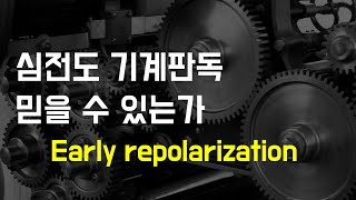 심전도 기계판독 믿을수 있을까  early repolarization 김교수의 실전 심전도 16강 [upl. by Vinny]