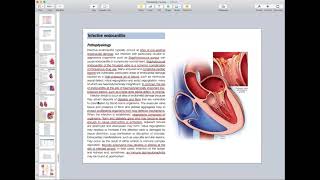 Infective Endocarditis Myocarditis Pericarditis  Cardiology Course [upl. by Retluoc]