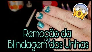 Remoção da Blindagem das Unhas [upl. by Nnyleuqaj]