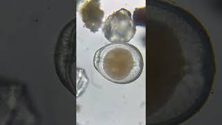 Foraminifera using its pseudopodia 😮 [upl. by Guimar714]