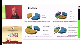 En directe du 12 ème Congrès Maghrébin de Neurologie Marrakech 2018 [upl. by Freyah]