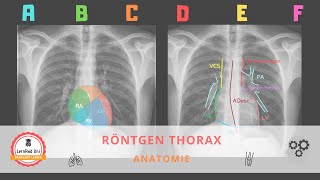 Anatomie im Röntgen Thorax [upl. by Lazes]