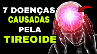 7 DOENÇAS CAUSADAS PELA TIREOIDE Hipotireoidismo e Hipertireoidismo [upl. by Ariet377]