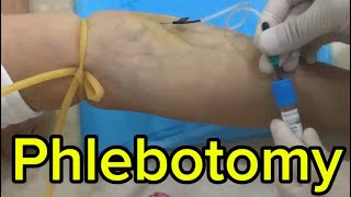 Phlebotomy phlebotomist phlezbotomybutterflyneedle technology education butterfly hospital [upl. by Boland]