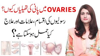 Anda Dani Ki Rasoli Ka Ilaj  Ovarian Cyst Signs And Symptoms  Dr Maryam Raana Gynaecologist [upl. by Eizle]