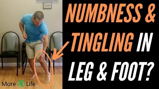 Numbness and Tingling In Leg and Foot [upl. by Fleeta]