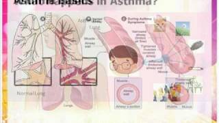 Asthma inhaler and spacer usePart 1 [upl. by Ahsiekat]