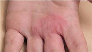 Dermatology Treatments  How to Diagnose Skin Rashes [upl. by Lunetta]