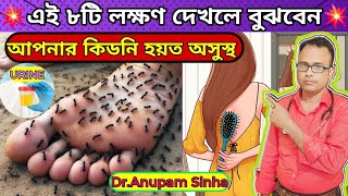 💥এই ৮টি লক্ষণ দেখলেই বুঝবেন আপনার কিডনি খারাপ হতে শুরু হয়েছে। Early Signs Of Kidney Disease [upl. by Jaban]