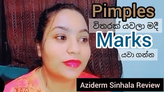 🦋 Azelaic Acid  Aziderm Sinhala Honest Review 🦋 [upl. by Anomor153]