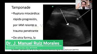 Tamponade ENARM [upl. by Idram]