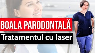 Tratamentul cu laser în boala parodontală [upl. by Oiralednac522]