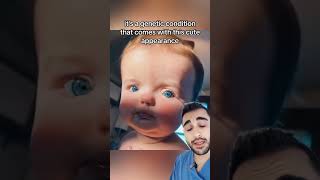 This is Called Waardenburg Syndrome🤯🤯Doctor Reacts [upl. by Eilyk]