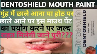 Dentoshield Mouth Paint Uses in Hindi Medicine uses support medicine [upl. by Stinson]