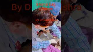 Colostomy bag care and Change procedure Colostomy and Ileostomy Stoma bag medical neet biology [upl. by Gotthard]