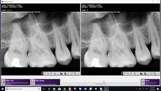 Training Apteryx XrayVision 4 Comparing Images [upl. by Cinimmod]