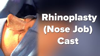 How Does a Rhinoplasty Nose Job Cast Work  Dr Lexie Wang  West End Plastic Surgery [upl. by Akehsar]