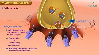 Myasthenia Gravis Etiology  Pathogenesis Classification  Clinical features Diagnosis Treatment [upl. by Kung]