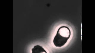 Crawling C elegans sperm [upl. by Deina]