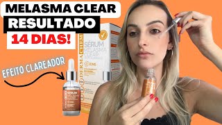 Comprei o Sérum Melasma Clair Efeito Clareador Dermachem RESENHA [upl. by Illehs123]