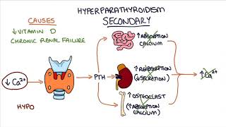 Understanding Hyperparathyroidism [upl. by Cathe]